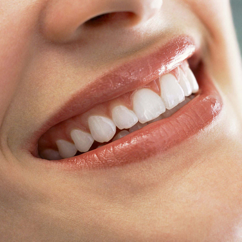 The image shows a smiling woman with straight teeth, wearing lipstick and lip gloss.
