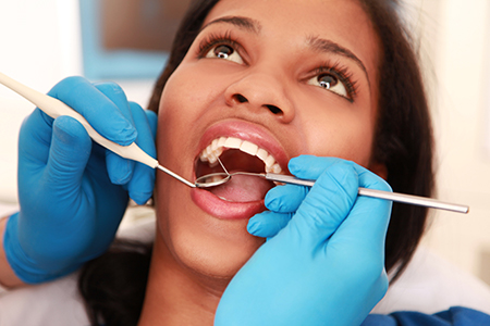 A woman receiving dental care, with her mouth open wide and a dental professional working on her teeth, wearing blue gloves and using specialized tools, all set against a clinical background.