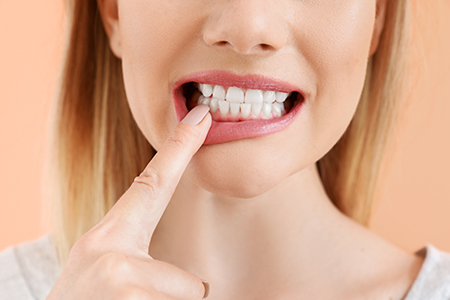 The image shows a person with their finger on their teeth, possibly brushing or cleaning them, against a plain background.